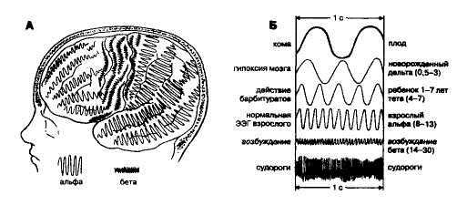 Общая частотно-амплитудная характеристика ЭЭГ человека