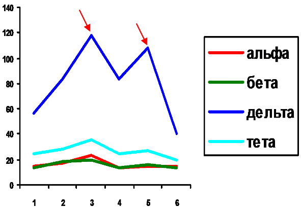 8-1. Динамика средних амплитуд медленных (тета, дельта) и быстрых (альфа, бета) волн в процессе реабилитации